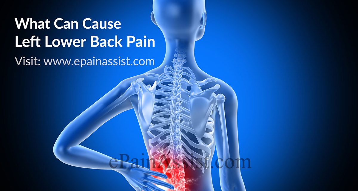 CAUSES OF LOW BACK PAIN