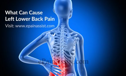 CAUSES OF LOW BACK PAIN